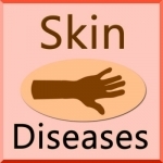 Skin Disease