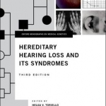 Hereditary Hearing Loss and Its Syndromes