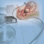 Actocardiogram: Analysis of Fetal Motion and Heart Rate