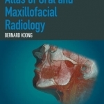 Atlas of Oral and Maxillofacial Radiology