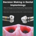 Decision Making in Dental Implantology: Atlas of Surgical and Restorative Approaches