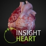 INSIGHT HEART