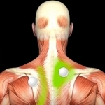 Muscle Trigger Points: Guide &amp; Reference
