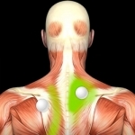 Muscle Trigger Points: Guide & Reference
