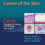 Cancer of the Skin: Cancer: Principles &amp; Practice of Oncology