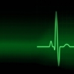 EKG Academy: Electrocardiogram Study Guide