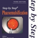 Step by Step Phacoemulsification