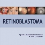 Retinoblastoma