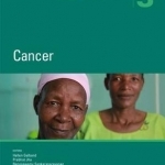 Disease Control Priorities: Volume 3: Cancer