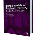 Fundamentals of Implant Dentistry: Prosthodontic Principles: 1