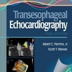 A Practical Approach to Transesophageal Echocardiography