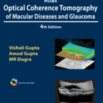 Atlas Optical Coherence Tomography of Macular Diseases and Glaucoma