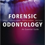 Forensic Odontology: An Essential Guide