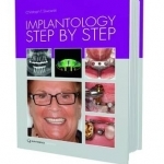 Implantology Step by Step