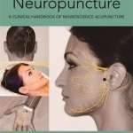 Neuropuncture: A Clinical Handbook of Neuroscience Acupuncture