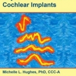 Objective Measures in Cochlear Implants