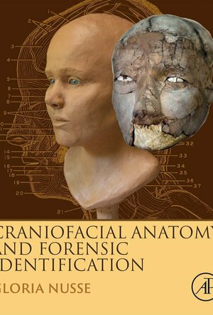 Craniofacial Anatomy and Forensic Identification