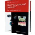 Practical Implant Dentistry