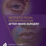 Aesthetic Facial Reconstruction After Mohs Surgery