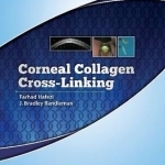 Corneal Collagen Cross Linking