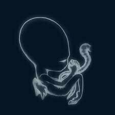 Ágætis byrjun by Sigur Ros