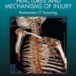 Forensic Pathology of Fractures and Mechanisms of Injury: Postmortem CT Scanning