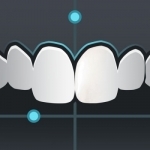 Smile Designer Pro