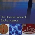 The Diverse Faces of Bacillus Cereus