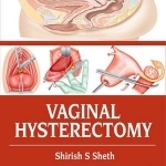 Vaginal Hysterectomy