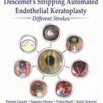 Descemet&#039;s Stripping Automated Endothelial Keratoplasty: Different Strokes