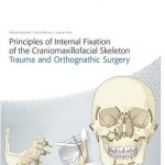 Principles of Internal Fixation of the Craniomaxillofacial Skeleton: Trauma and Othognathic Surgery