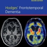 Hodges&#039; Frontotemporal Dementia