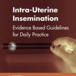 Intra-Uterine Insemination: Evidence Based Guidelines for Daily Practice