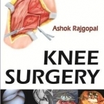 Knee Surgery