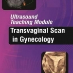 Ultrasound Teaching Module: Transvaginal Scan in Gynecology