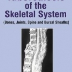 Tuberculosis of the Skeletal System