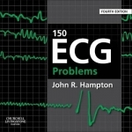 150 ECG Problems