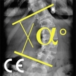 CobbMeter CE