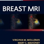 Breast MRI