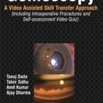 Gonioscopy: A Video Assisted Skill Transfer Approach