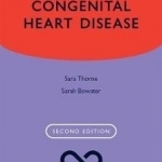 Adult Congenital Heart Disease